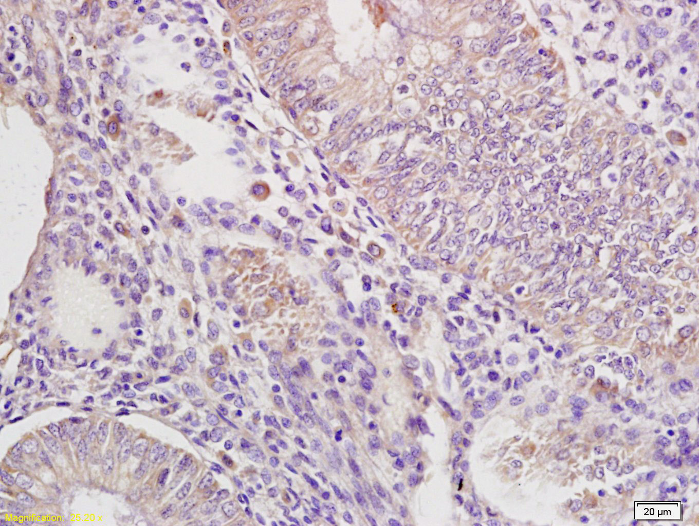 IRAK4 Rabbit pAb(bs-2440R)-50u