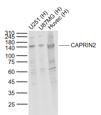 CAPRIN2 Rabbit pAb(bs-12423R)-