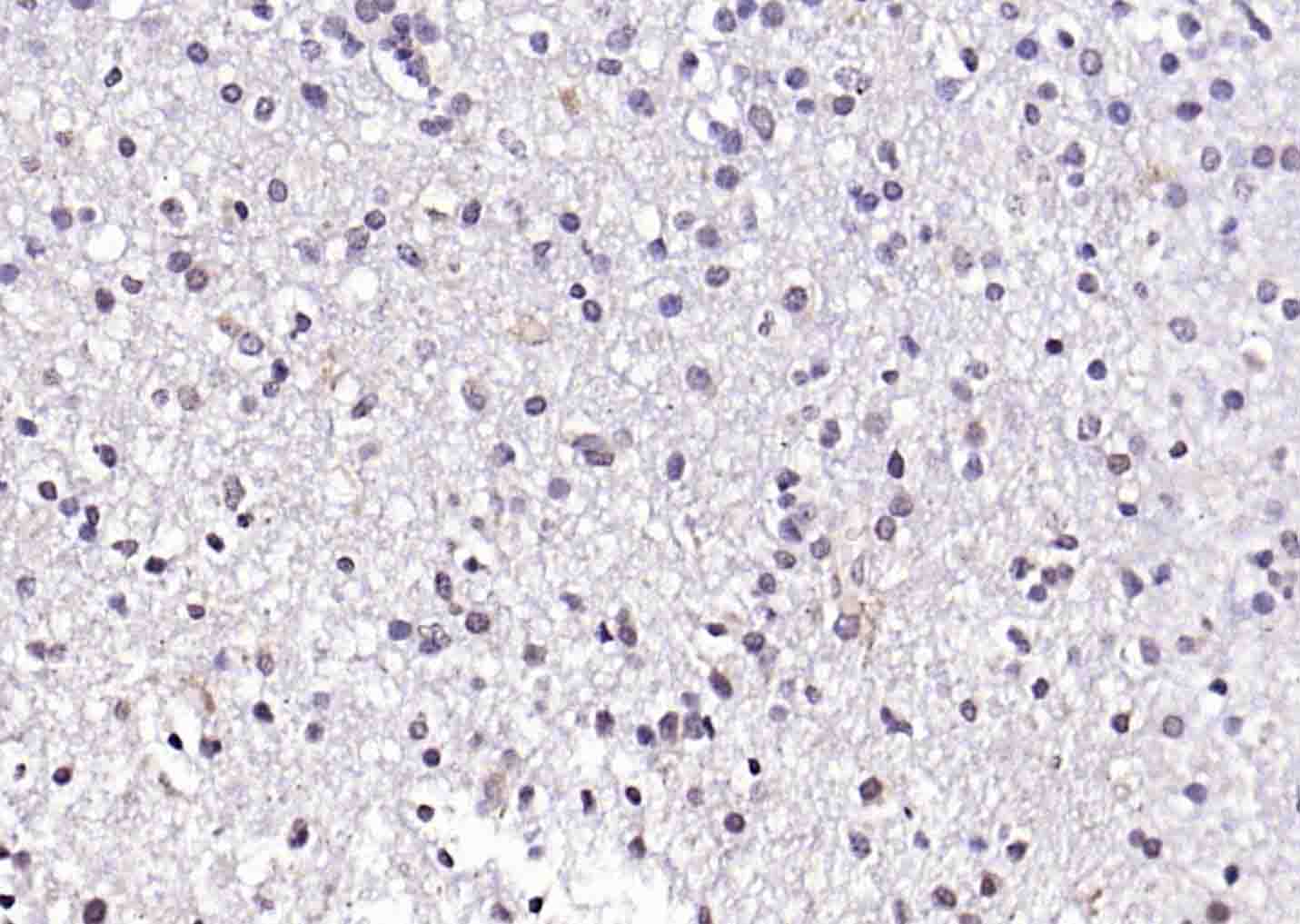 CREB5 Rabbit pAb(bs-14053R)-50