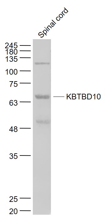 KBTBD10 Rabbit pAb(bs-8044R)-5