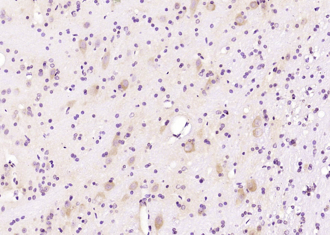 Artemin Rabbit pAb(bs-22202R)-