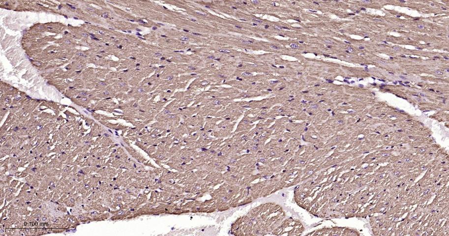 VDAC1 Recombinant Rabbit mAb, 