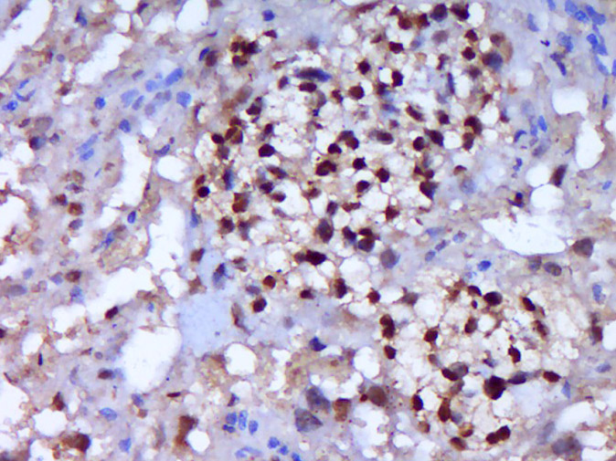 Caspase-7 p20 Rabbit pAb(bs-36