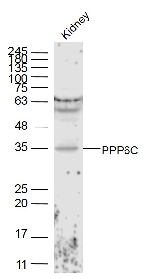 PPP6C Rabbit pAb(bs-19975R)-50