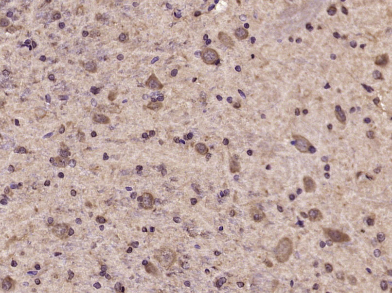 phospho-Tyk2 (Tyr1054 + Tyr105