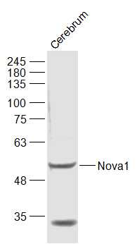 Nova1 Rabbit pAb(bs-11324R)-50