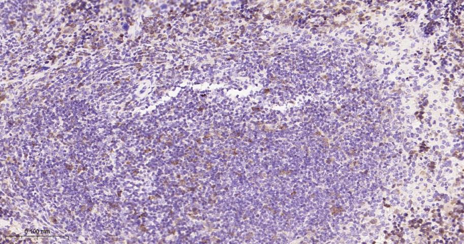 TYMS Recombinant Rabbit mAb(bs