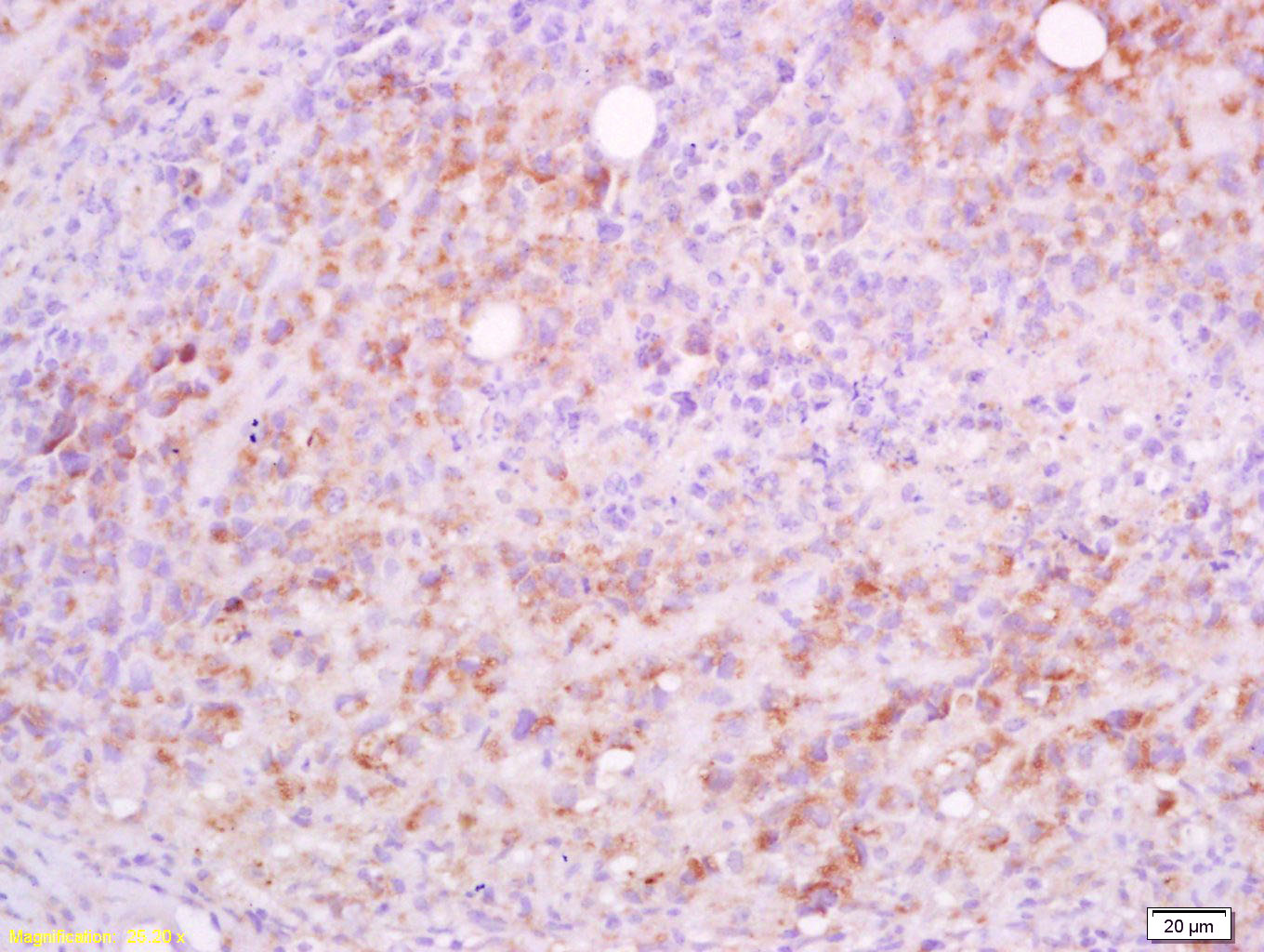 CD5L Rabbit pAb(bs-2487R)-50ul