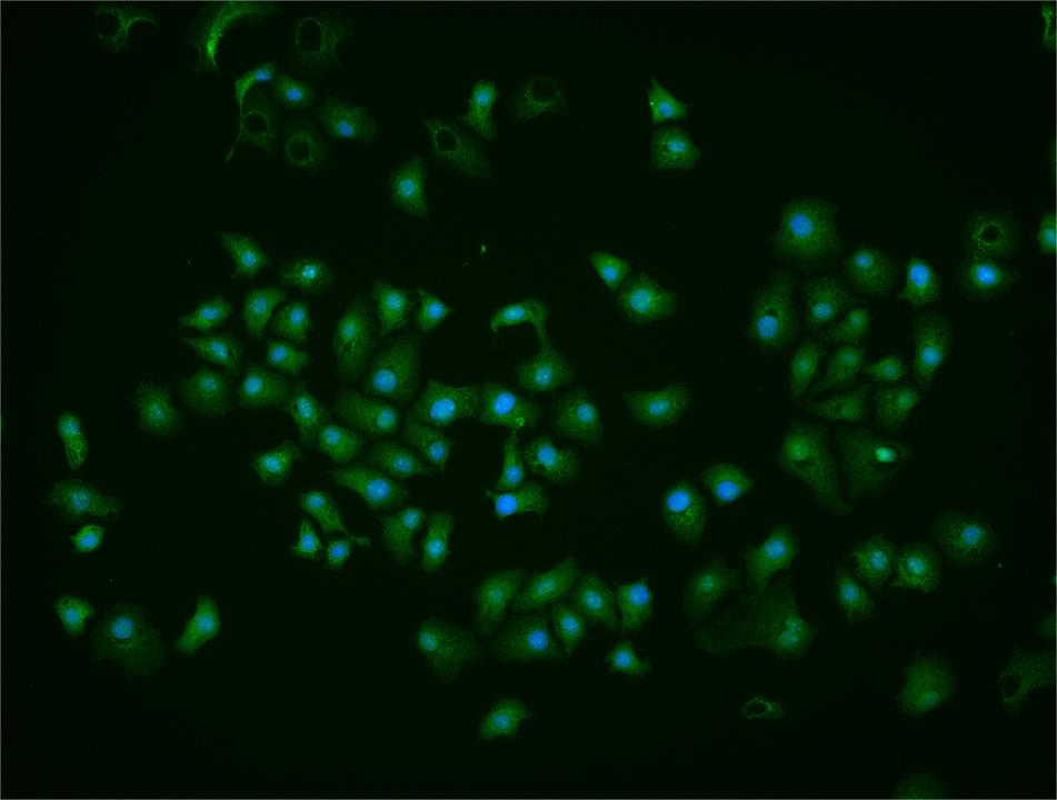 HSF1 Rabbit pAb(bs-3757R)-50ul