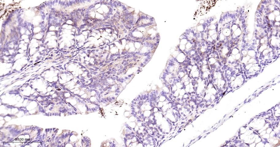 GBA Recombinant Rabbit mAb(bsm