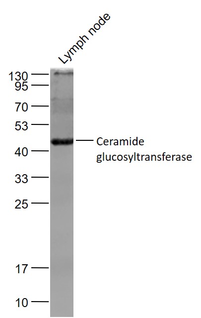 Ceramide glucosyltransferase R
