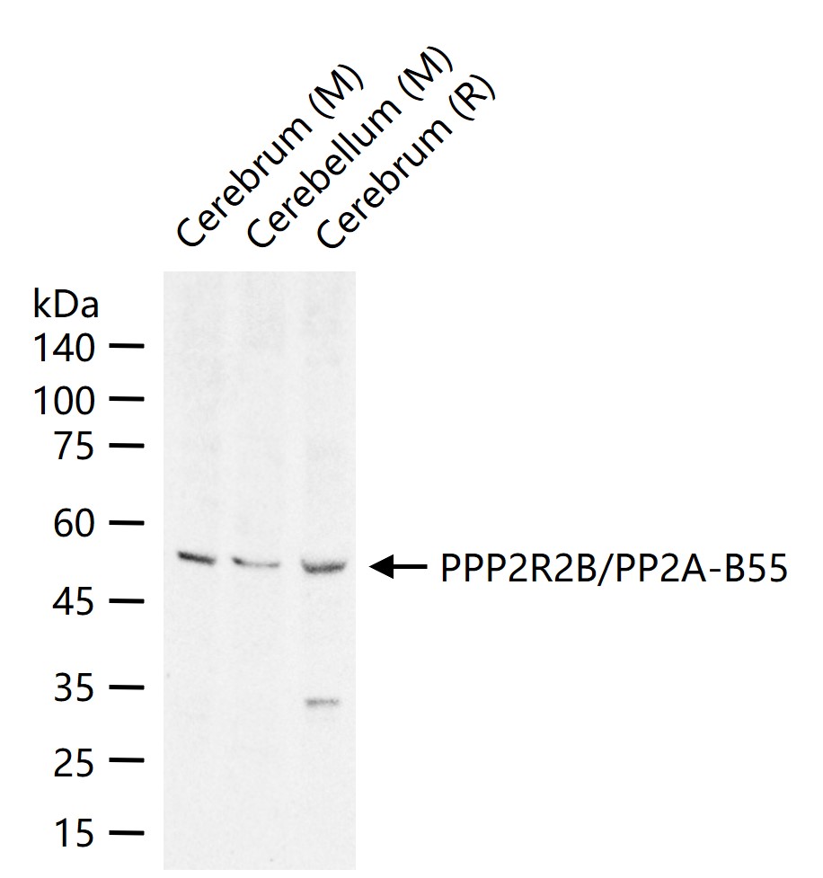 PPP2R2B/PP2A-B55 Rabbit pAb(bs