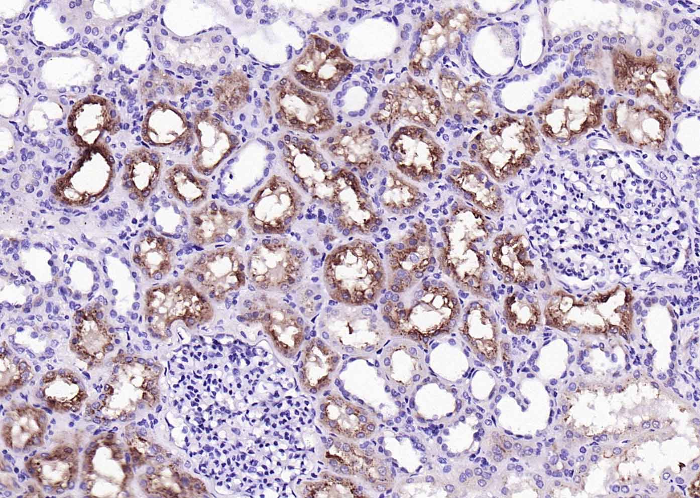 RBP4 Mouse mAb(bsm-43011M)-50u