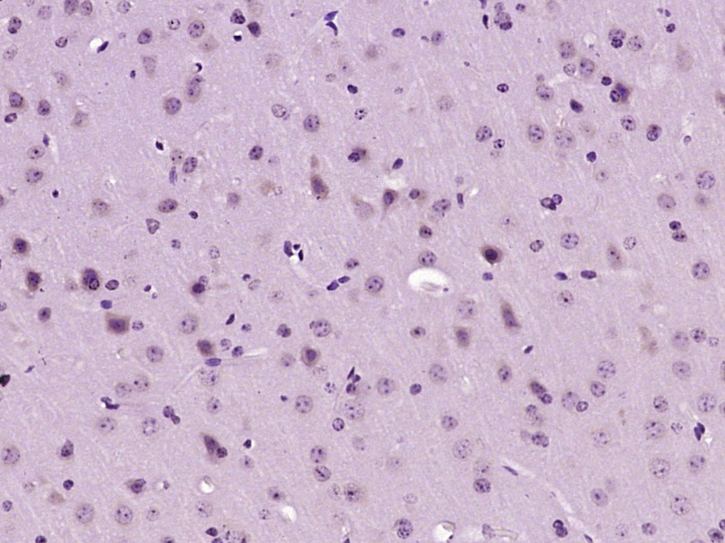 PGAM5 Rabbit pAb(bs-18228R)-50