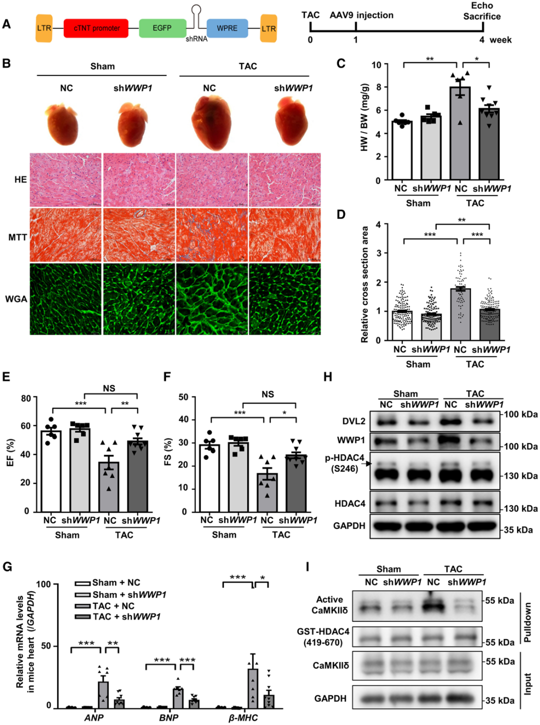 IF=23.603【AAV在心脏疾病中的应用】科学家揭示病理性心肌肥厚及心力衰竭治疗的潜在靶点