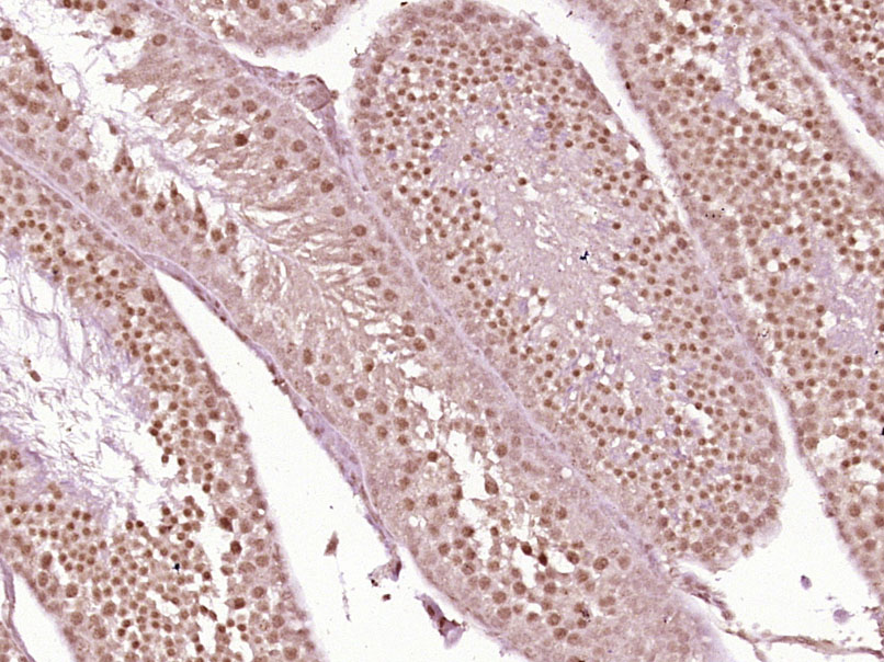 phospho-KLF5 (Ser311) Rabbit p