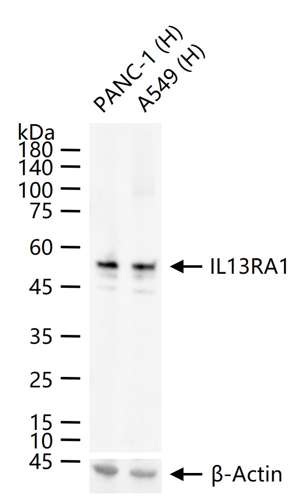 IL13RA1 Recombinant Rabbit mAb