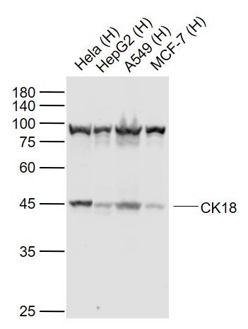 CK18 Mouse mAb(bsm-33102M)-50u