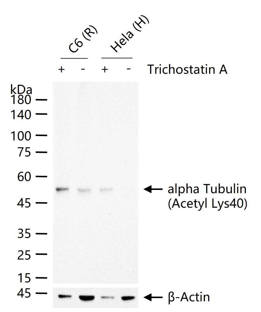 alpha Tubulin (Acetyl Lys40) M