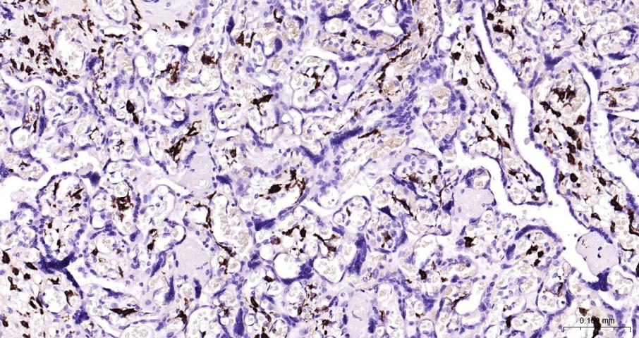 CD163 Rabbit pAb(bs-2527R)-50u