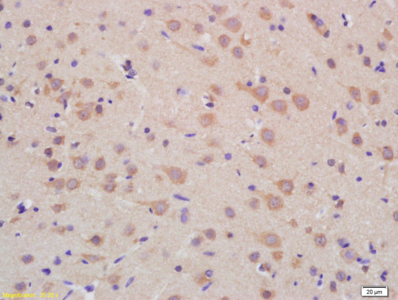 PMPCB Rabbit pAb(bs-7003R)-50u