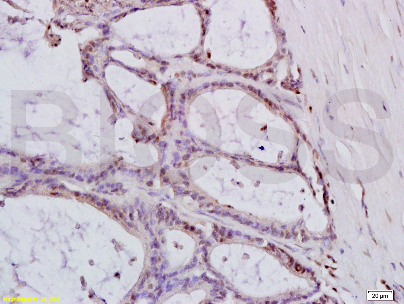 MTLC Rabbit pAb(bs-0334R)-50ul