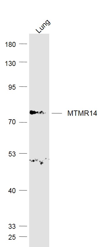MTMR14 Rabbit pAb(bs-11217R)-5
