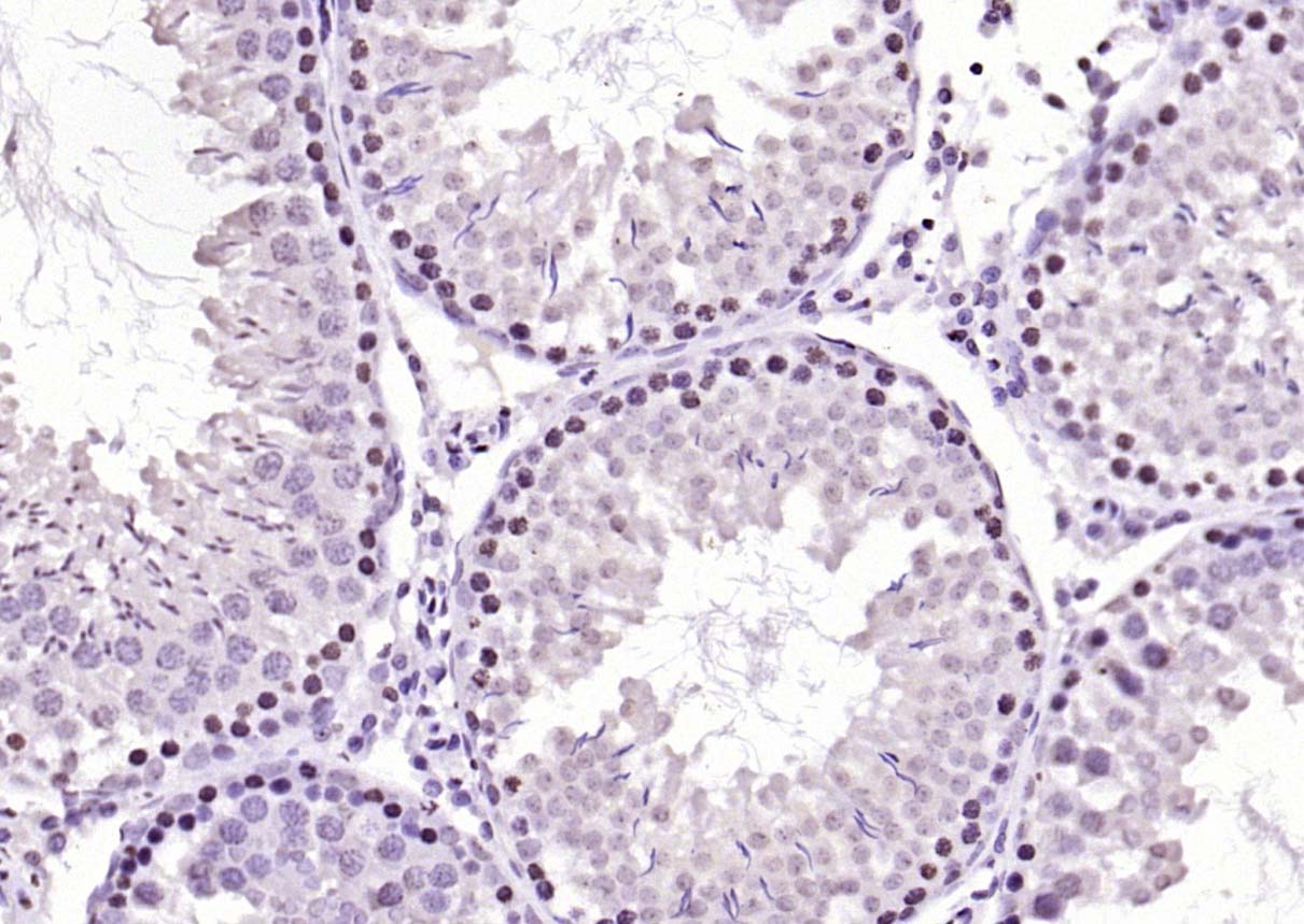 SIK1 Rabbit pAb(bs-6252R)-50ul