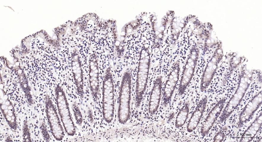 PI3 Kinase p110 beta Rabbit pA