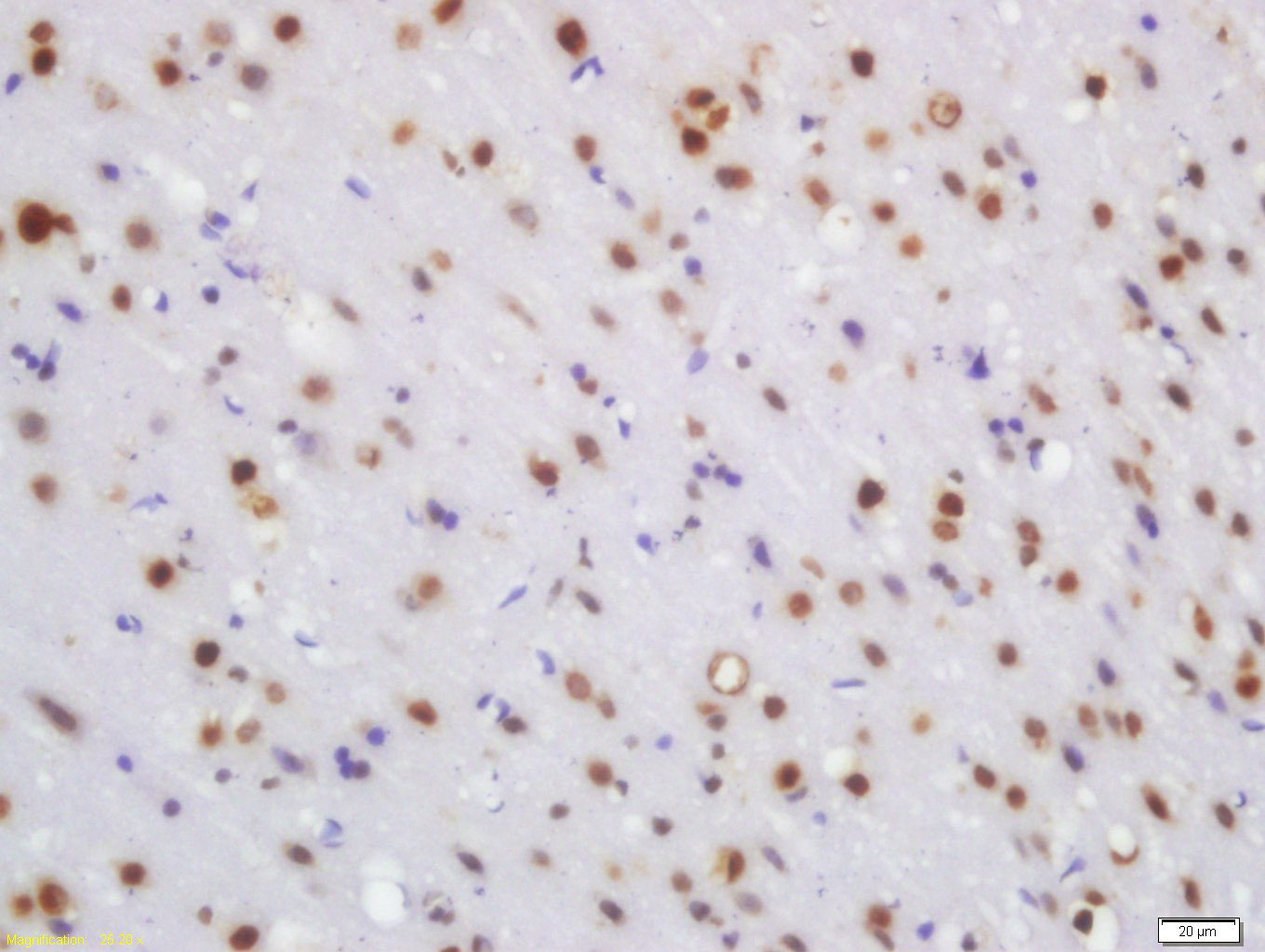 WRB Rabbit pAb(bs-11774R)-50ul