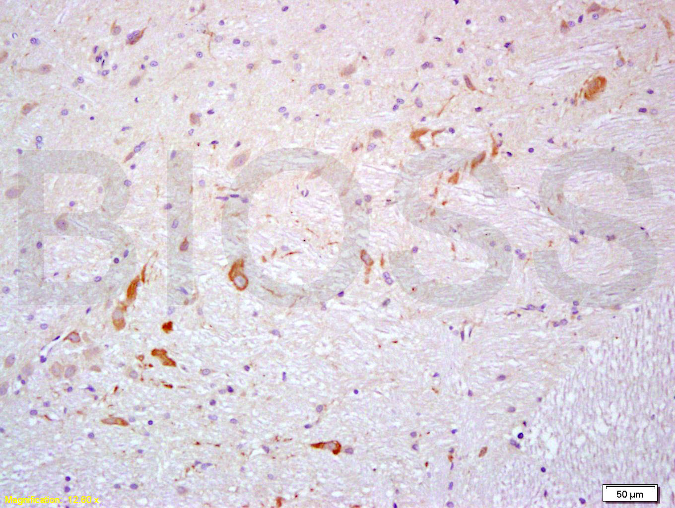 PROK2 Rabbit pAb(bs-5784R)-50u