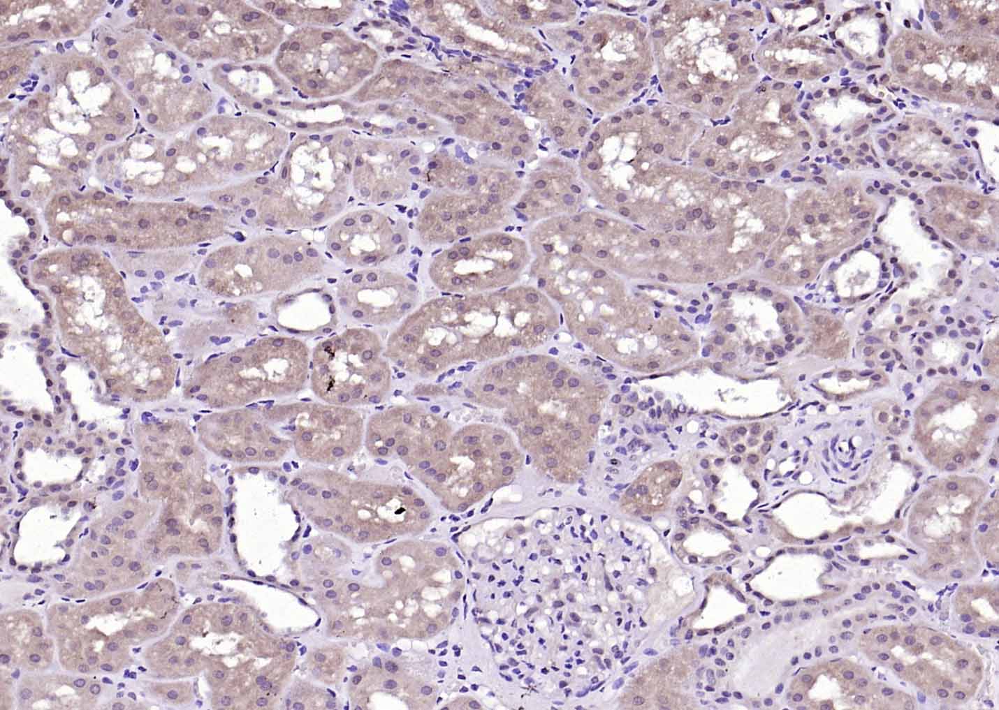 phospho-Tyk2 (Tyr1054 + Tyr105