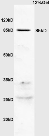 PIK3R2 Rabbit pAb(bs-4160R)-50