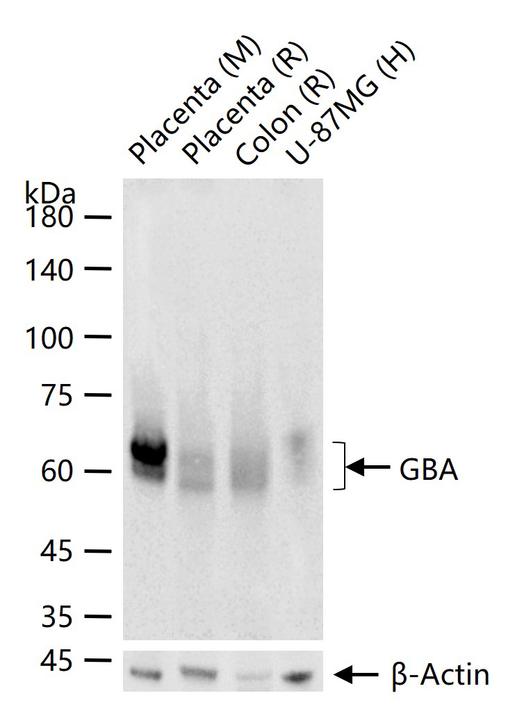 GBA Recombinant Rabbit mAb(bsm