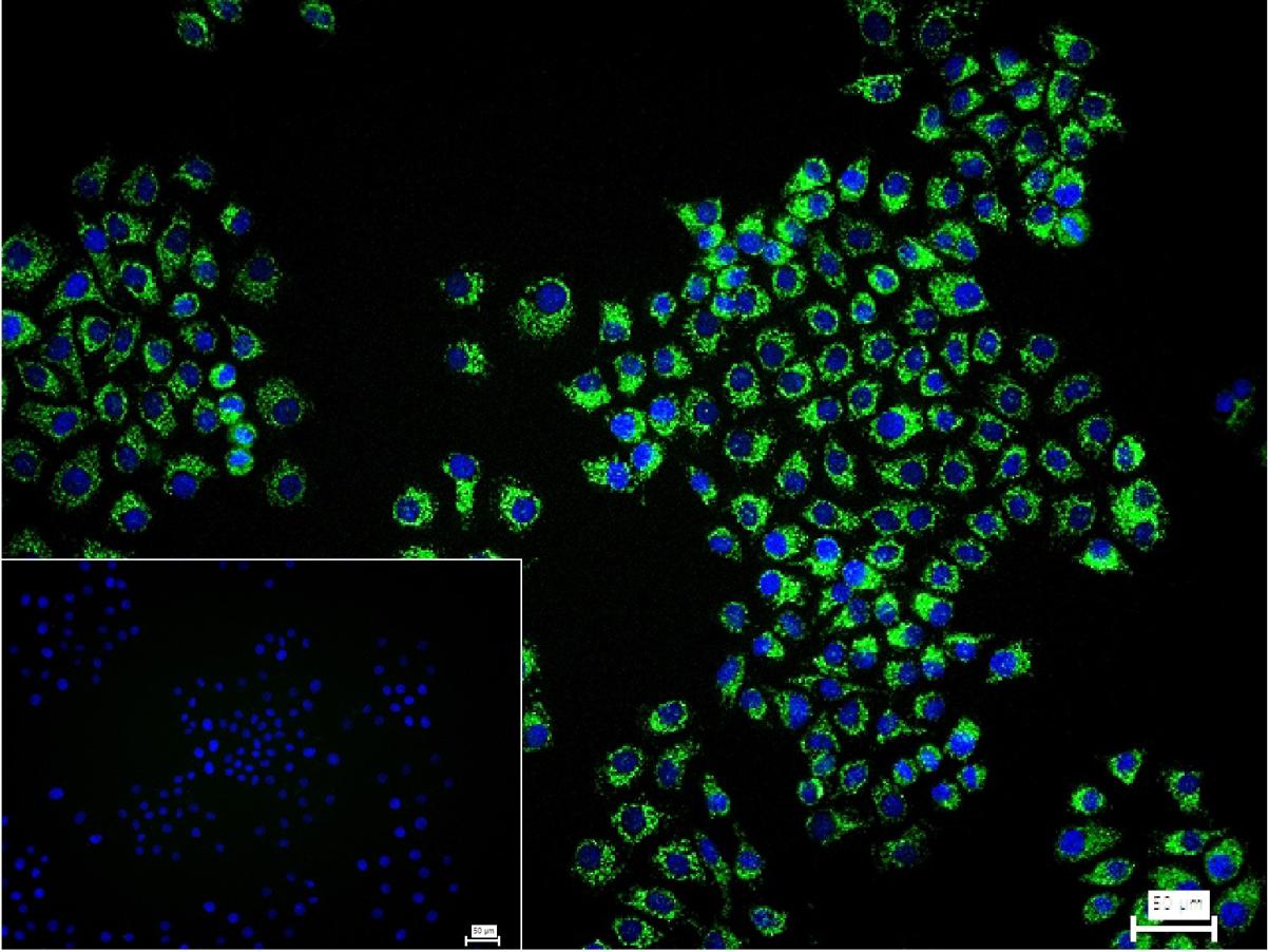 VDAC1 Recombinant Rabbit mAb, 