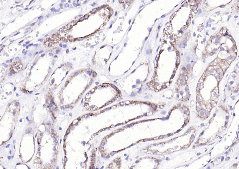 ECM1 Rabbit pAb(bs-0776R)-50ul