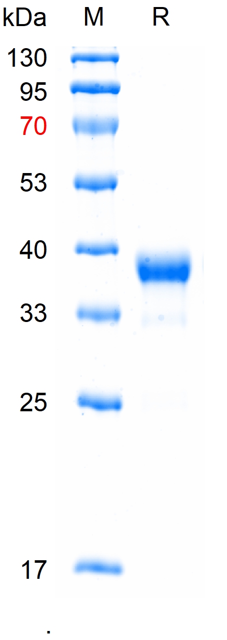 Recombinant human Caspase-3 pr