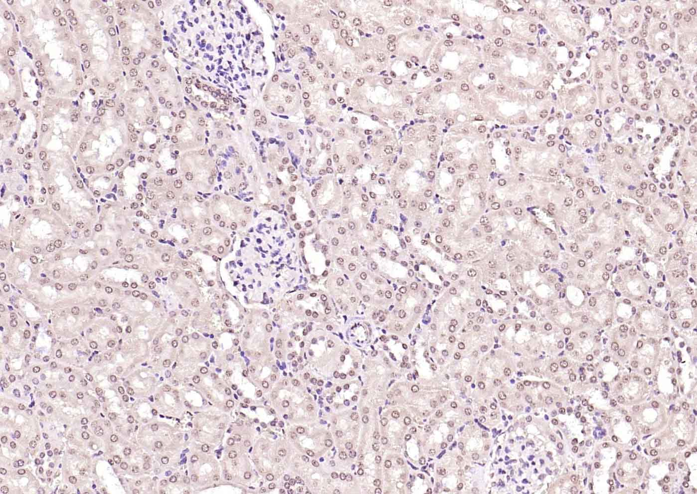 HSF1 Rabbit pAb(bs-3757R)-50ul