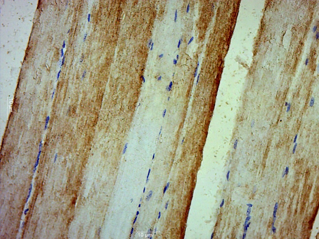 MYLPF Rabbit pAb(bs-5159R)-50u