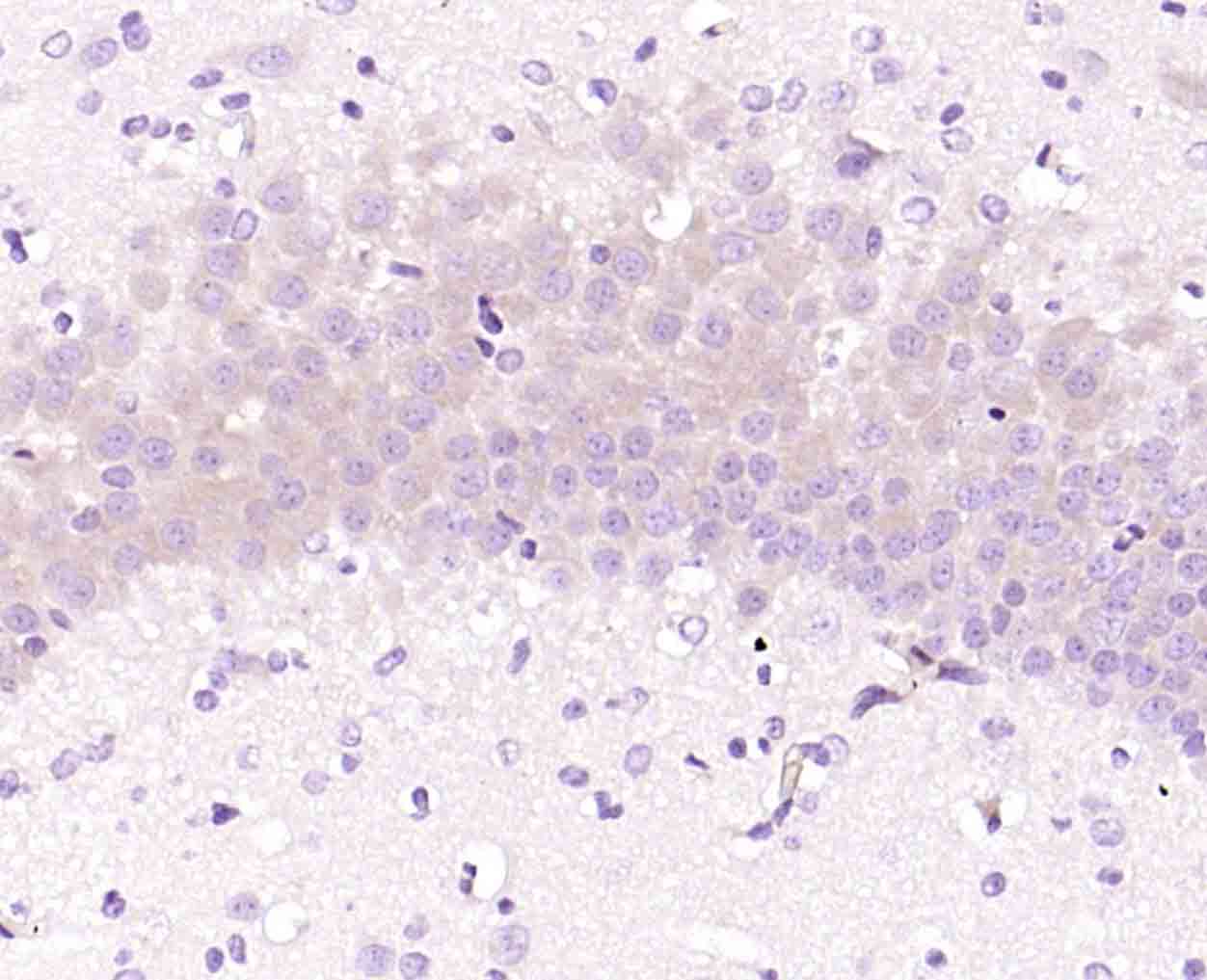 phospho-AKT1S1 (Thr246) Rabbit