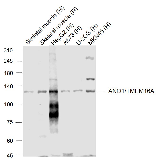 ANO1/DOG1 Rabbit pAb(bs-3794R)