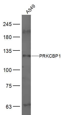 PRKCBP1 Rabbit pAb(bs-19178R)-