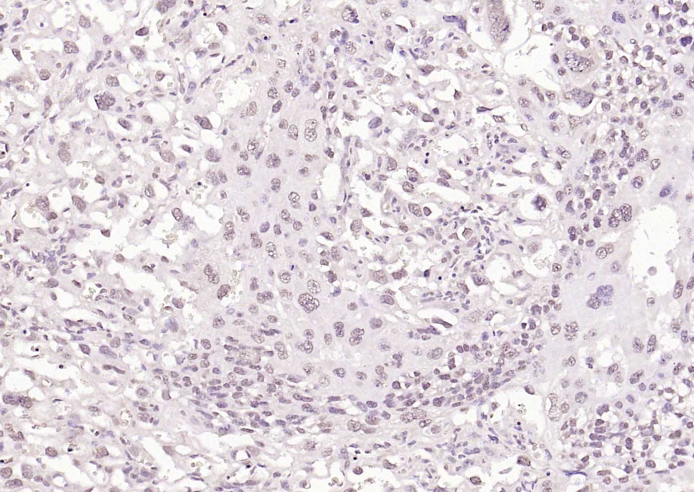 HSF1 Rabbit pAb(bs-3757R)-50ul