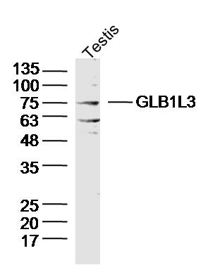 GLB1L3 Rabbit pAb(bs-8409R)-50