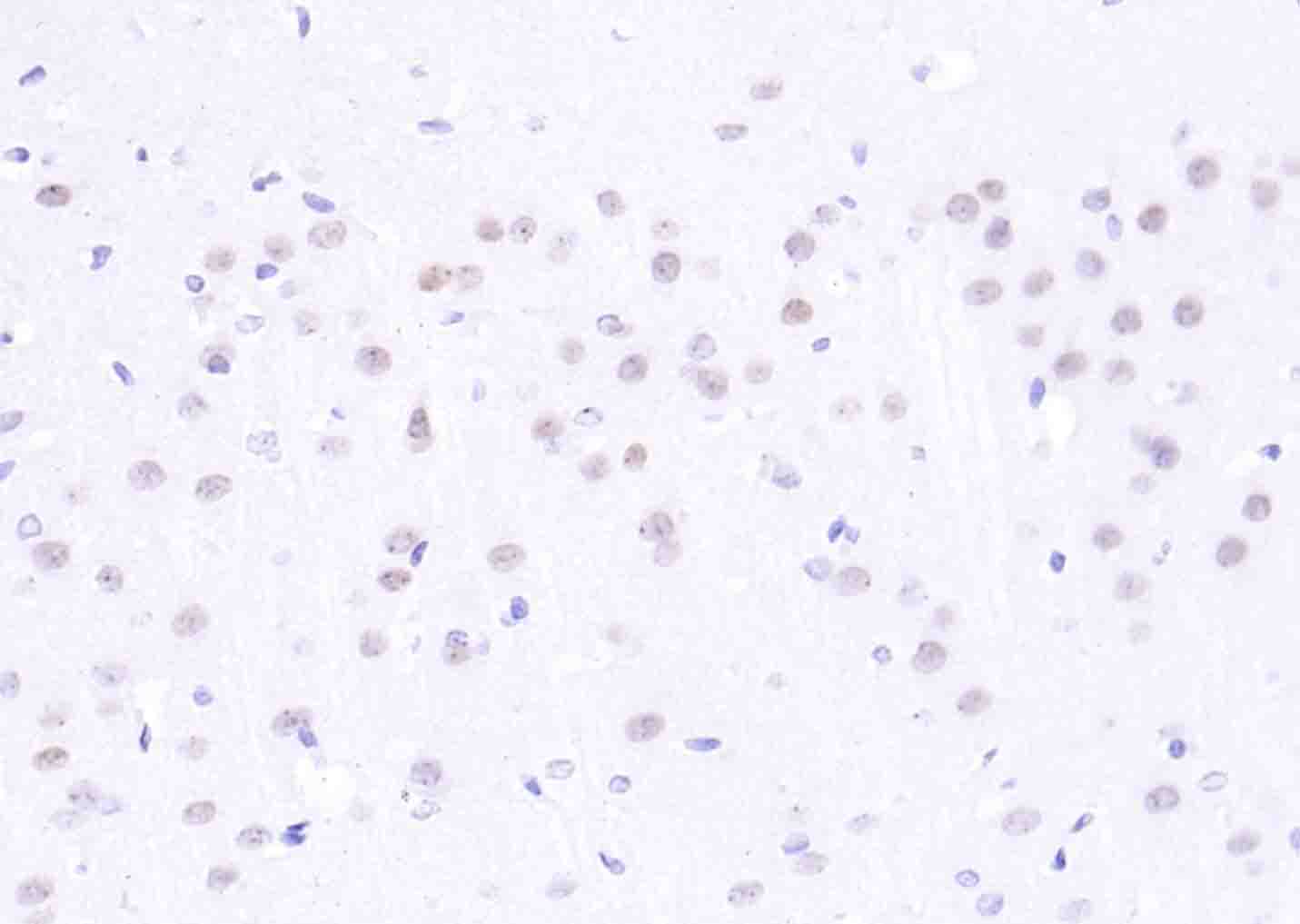 H2AX Rabbit pAb(bs-2560R)-50ul