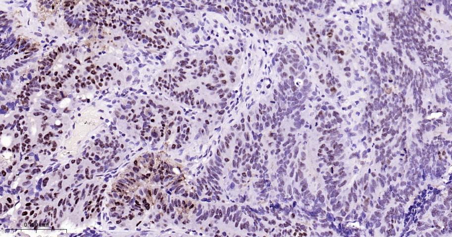 phospho-STAT3 (Tyr705) Mouse m