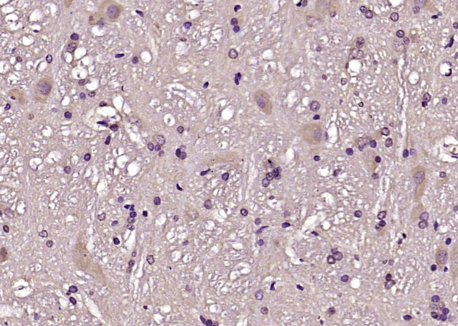 CBLN1 Rabbit pAb(bs-11814R)-50