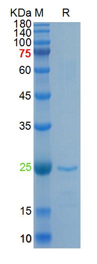 Recombinant SARS-Cov-2 N prote