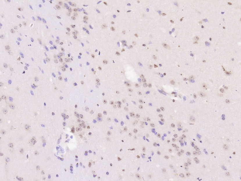 Phosphor-PPP3CA (Ser469) Rabbi