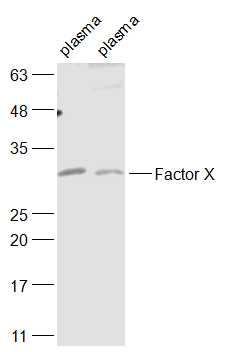 Factor X Rabbit pAb(bs-9501R)-